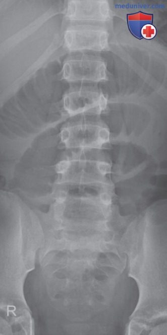 ������������ �� ������������� ��������������� �������� ���������� ��� �������� (������������) ��������������