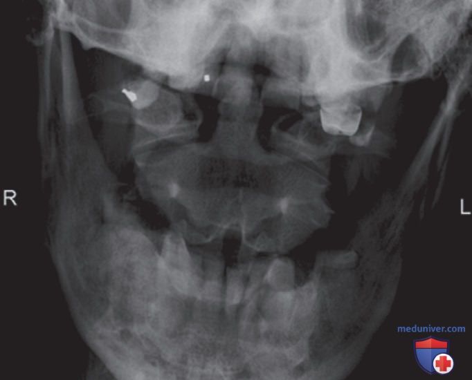 ������������ �� ������������� ��������������� �������� ���������� ��� �������� (������������) ��������������