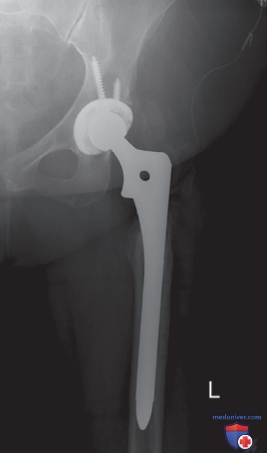 ������������ �� ������������� ��������������� �������� ���������� ��� �������� (������������) ��������������