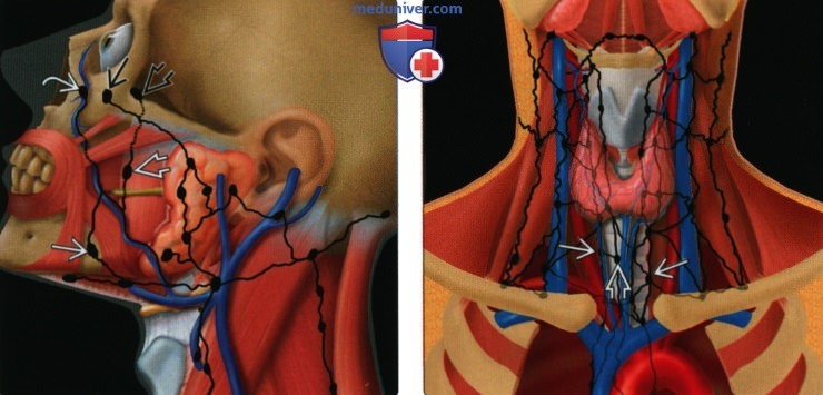 Введение в лучевую диагностику лимфатических узлов шеи: лучевая анатомия, методы исследования