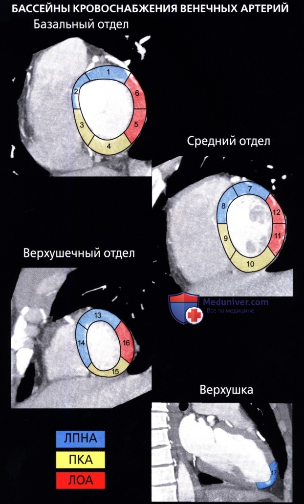 Лучевая анатомия коронарных артерий и вен сердца