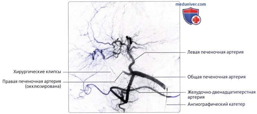 Лучевая анатомия (КТ, МРТ анатомия) желчевыводящей системы