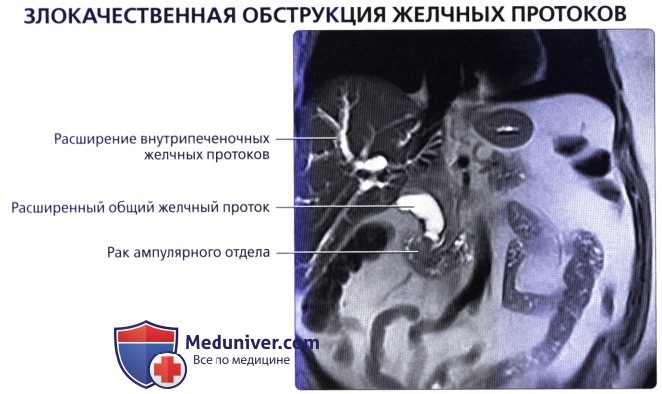 luchevaia anatomia gelchevivodiachei sistemi 45
