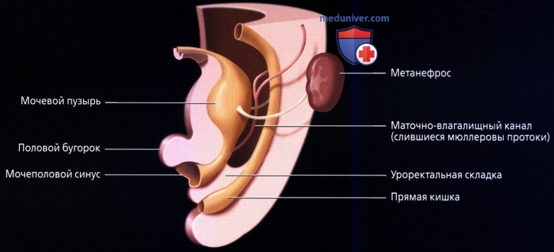Лучевая анатомия (КТ, МРТ анатомия) матки
