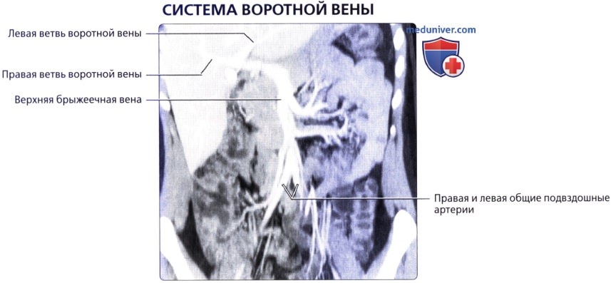 Лучевая анатомия (КТ, МРТ анатомия) печени