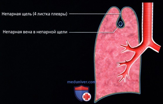 Лучевая анатомия (рентген, КТ анатомия) плевры