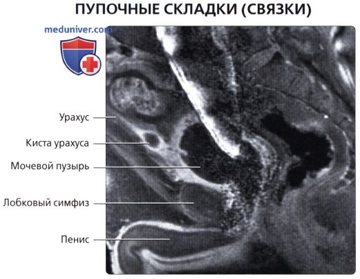 Лучевая анатомия (КТ, МРТ анатомия) полости брюшины