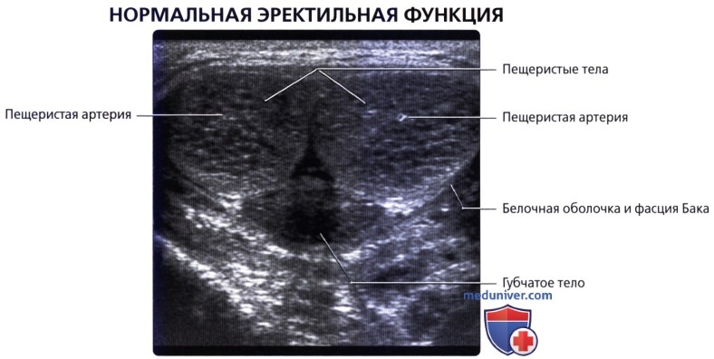 Лучевая анатомия (КТ, МРТ анатомия) полового члена и мочеиспускательного канала