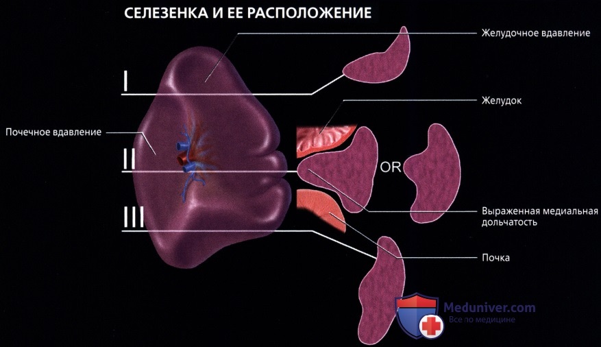 Лучевая анатомия (КТ, МРТ анатомия) селезенки