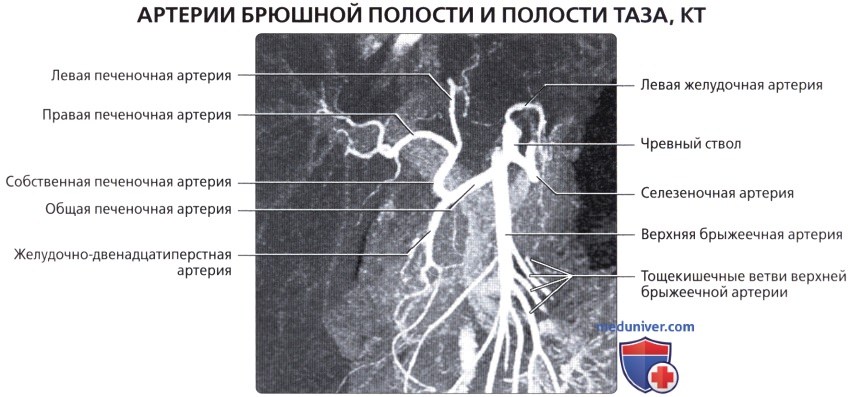 Лучевая анатомия (КТ, МРТ анатомия) сосудов, нервов, лимфатических узлов брюшной полости