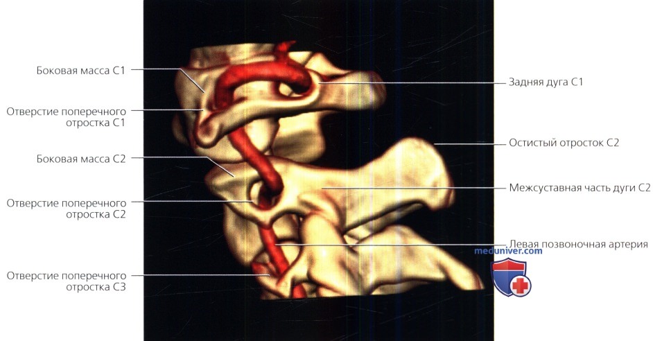 Анатомия позвоночника и аорты thumbnail