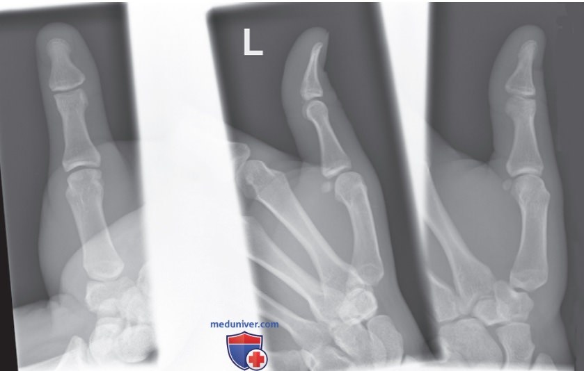 ���������� � ������ ������������ ��������� �������� �� ��������������