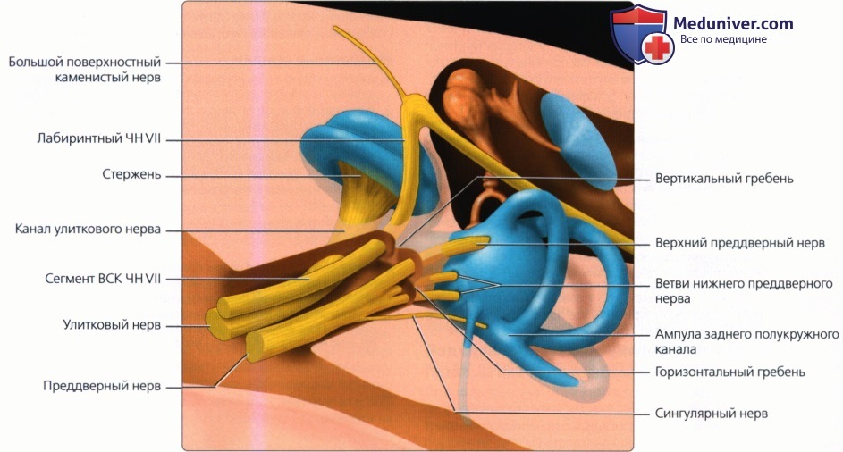 Введение в лучевую диагностику мостомозжечкового угла (ММУ) и внутреннего слухового канала (ВСК)