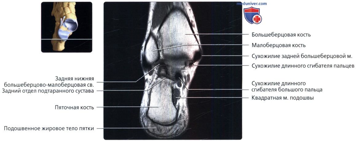Сухожилия голеностопного сустава анатомия мрт thumbnail