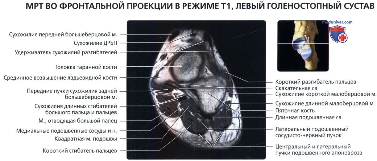 Голеностопный сустав мрт анатомия и описание thumbnail