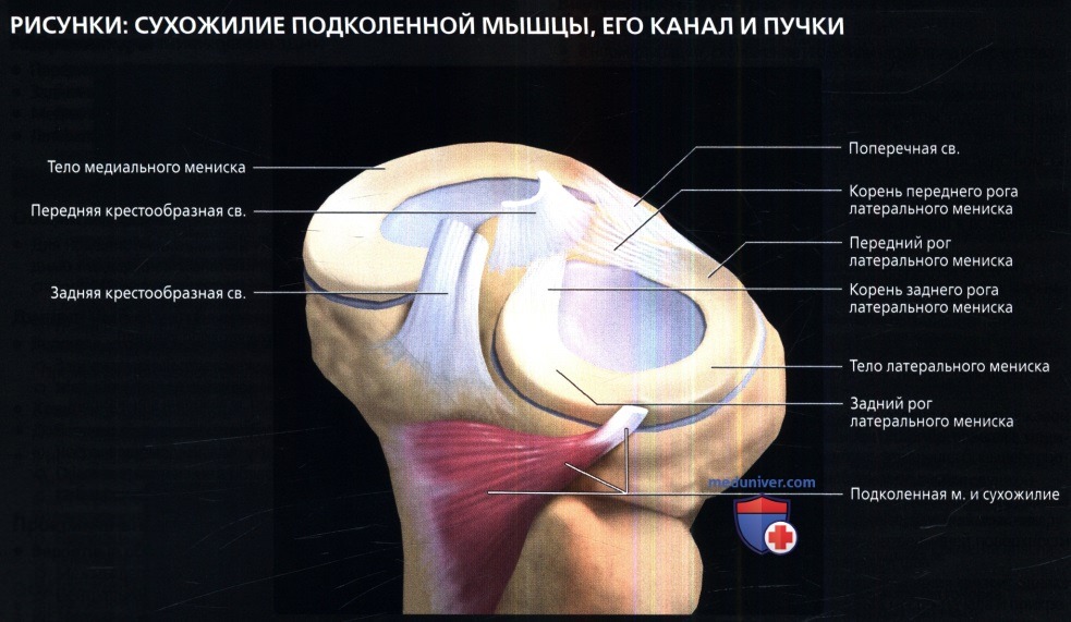 МРТ медиального мениска коленного сустава в норме