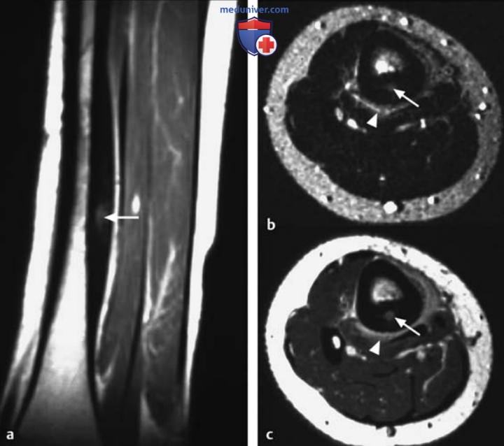 ��� ����������������� �������� ������ � ��������������� ���������