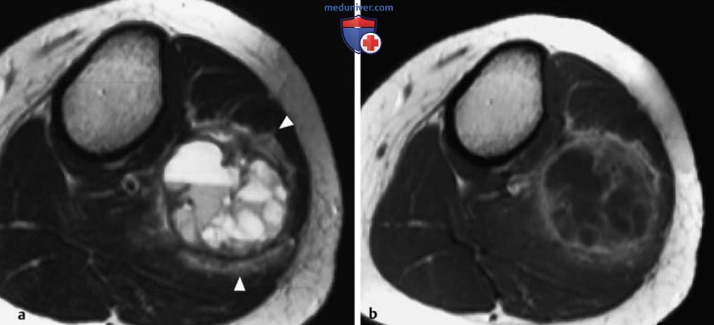 ��� ����������������� �������� ������ � ��������������� ���������