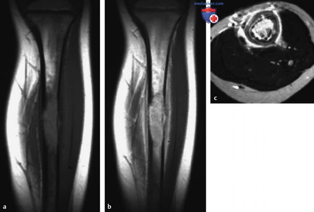 ��� ����������������� �������� ������ � ��������������� ���������