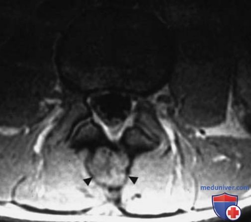 ��� ����������������� �������� ������ � ��������������� ���������