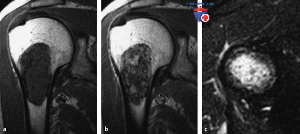 ��������� � �������� ���������� ��� ������� ������ � ������ ������