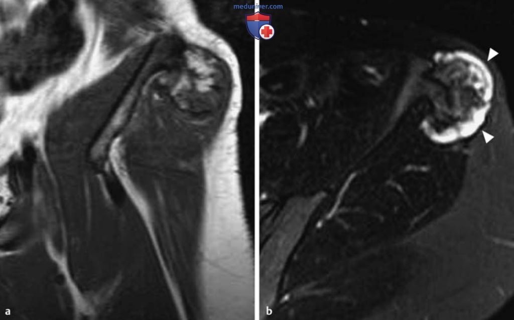 ��� ����������������� �������� ������ � ��������������� ���������