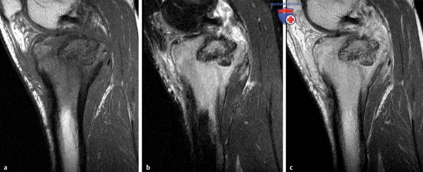 ��� ����������������� �������� ������ � ��������������� ���������