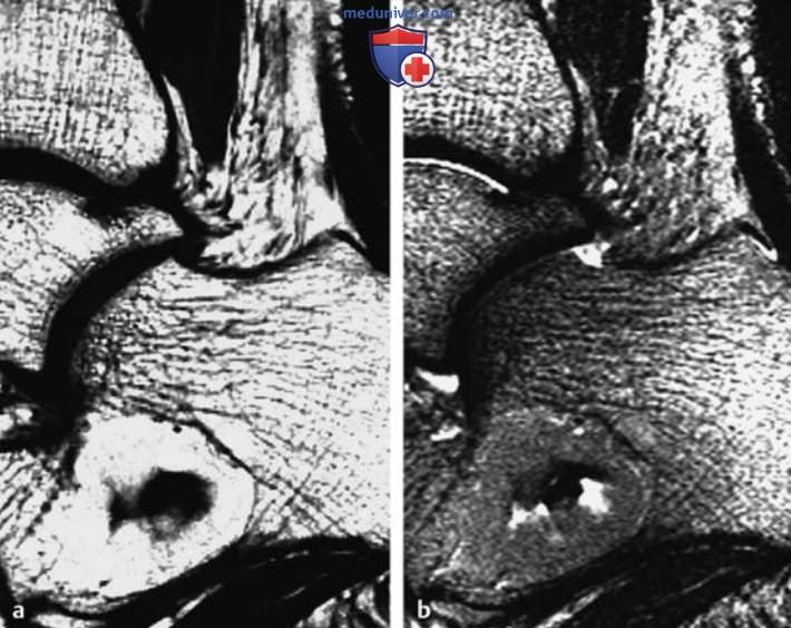 ��� ����������������� �������� ������ � ��������������� ���������