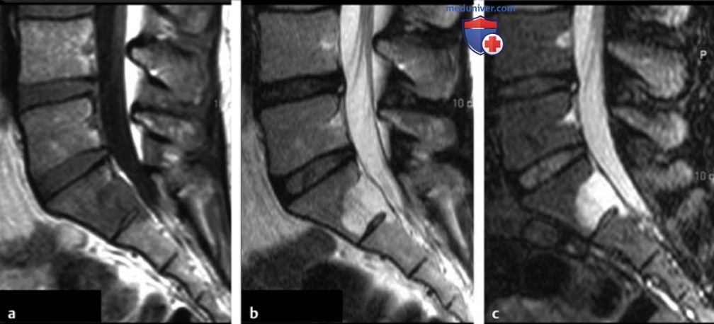 ��� ����������������� �������� ������ � ��������������� ���������