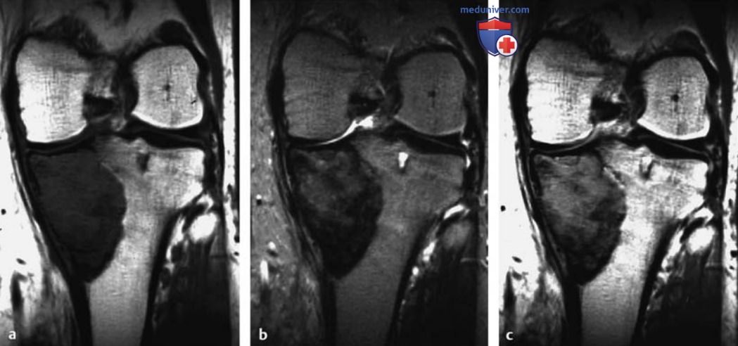 ��� ����������������� �������� ������ � ��������������� ���������