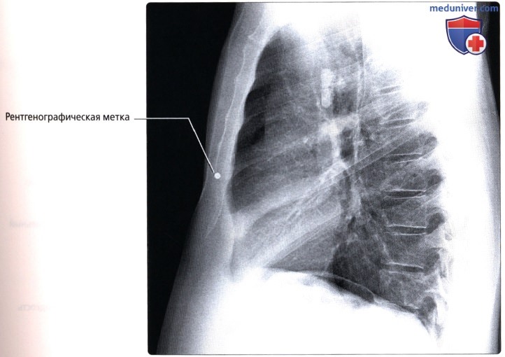 Анатомическая локализация при ортогональной рентгенографии органов грудной клетки