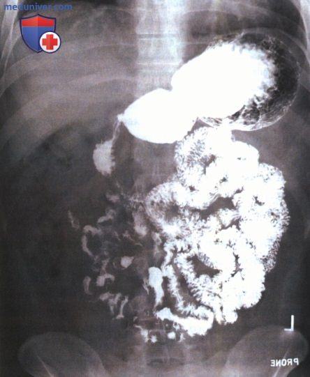 Технические параметры рентгенограмм органов желудочно-кишечного тракта