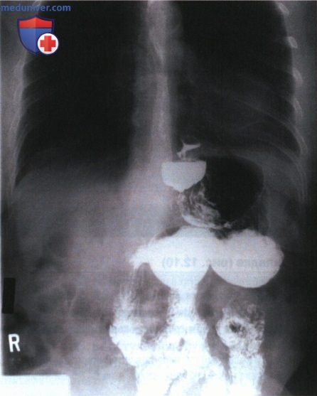 Технические параметры рентгенограмм органов желудочно-кишечного тракта