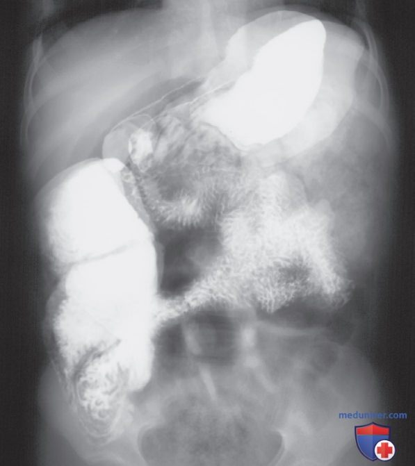 ���������������� ���������� �������������� ��� ������ �� ��������