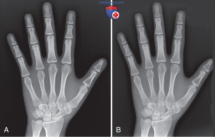 ���������������� ���������� �������������� ��� ������ �� ��������