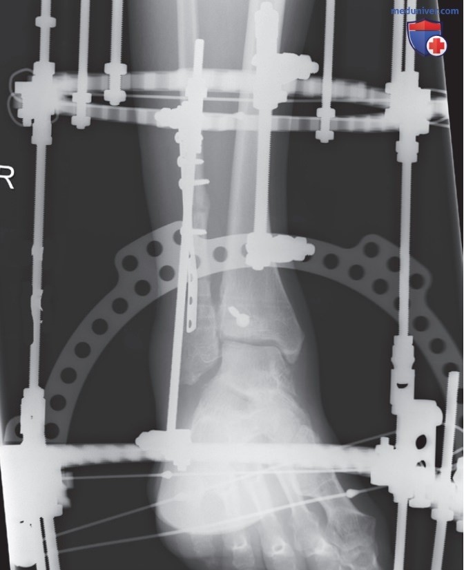 ���������������� ���������� �������������� ��� ������ �� ��������