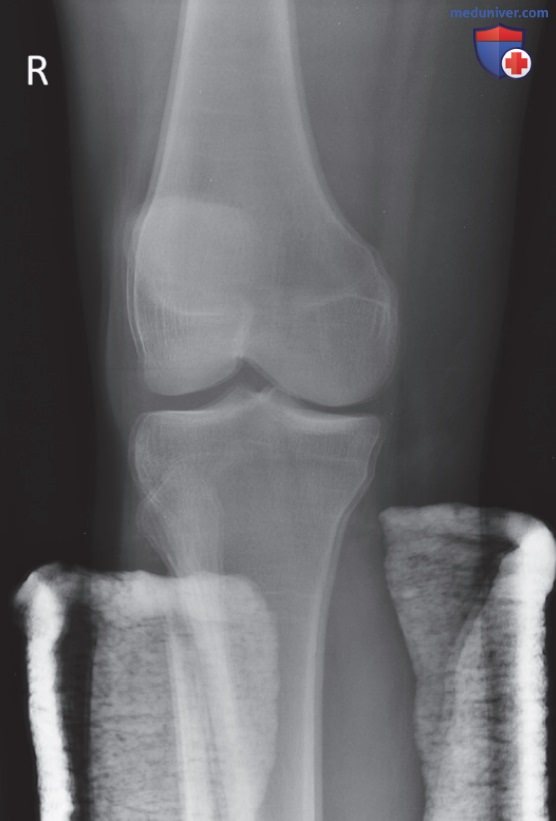 ���������������� ���������� �������������� ��� ������ �� ��������