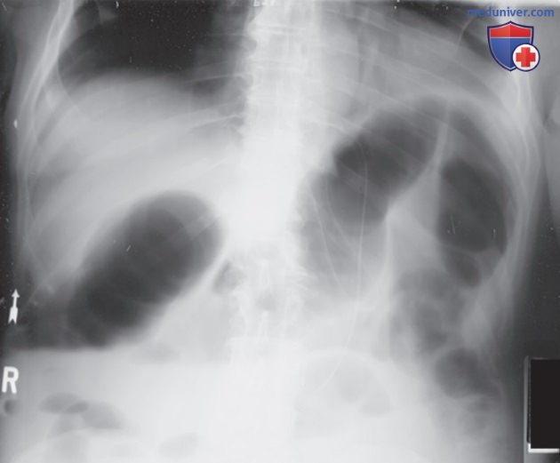 ���������������� ���������� �������������� ��� ������ �� ��������