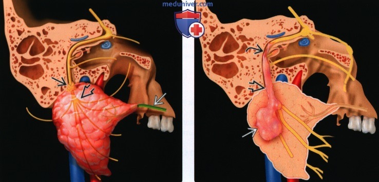 Введение в лучевую диагностику пространства околоушной железы: лучевая анатомия, методы исследования