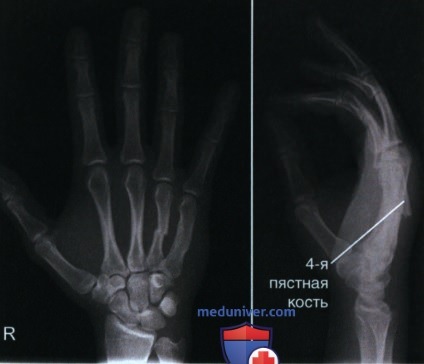 Советы по рентгенографии передвижным аппаратом и рентгенографии в травматологии