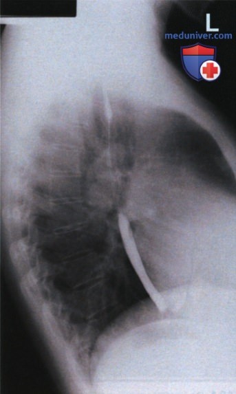 Подготовка к рентгенографии верхнего отдела пищеварительного тракта