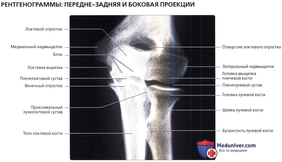 Рентген нормального локтевого сустава thumbnail