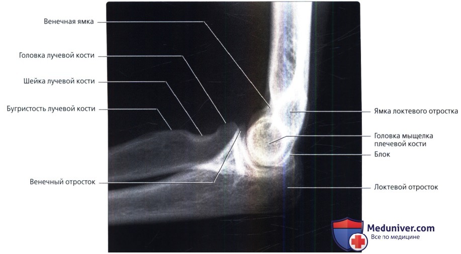 Рентгенограмма локтевого сустава в норме