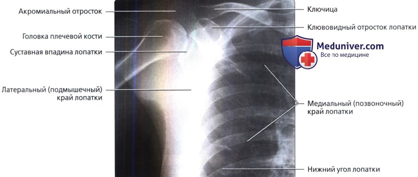 Рентгенограмма плечевого сустава в норме