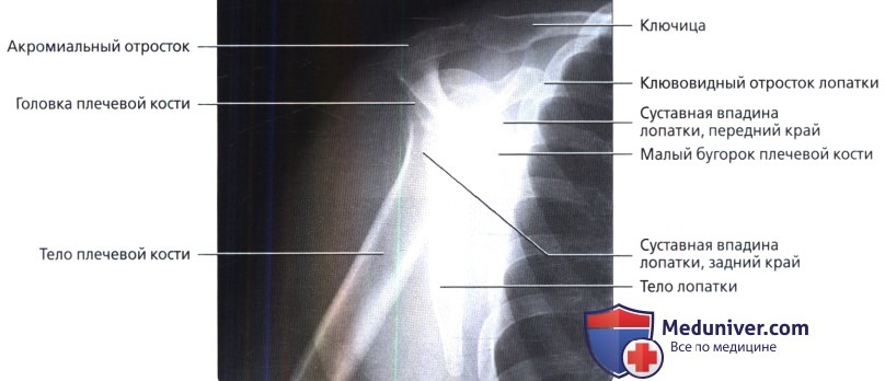 Рентгенограмма плечевого сустава в норме