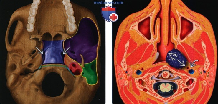 Введение в лучевую диагностику слизистого пространства глотки: лучевая анатомия, методы исследования