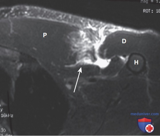 MPT-������� ���������� �����