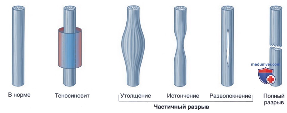 MPT-������� �������������� ��������� ���������