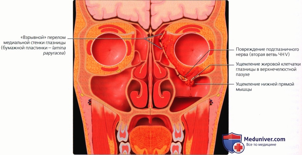 Введение в лучевую диагностику травм основания черепа и области лица: лучевая анатомия, методы исследования