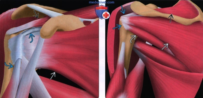Введение в лучевую диагностику травм плеча